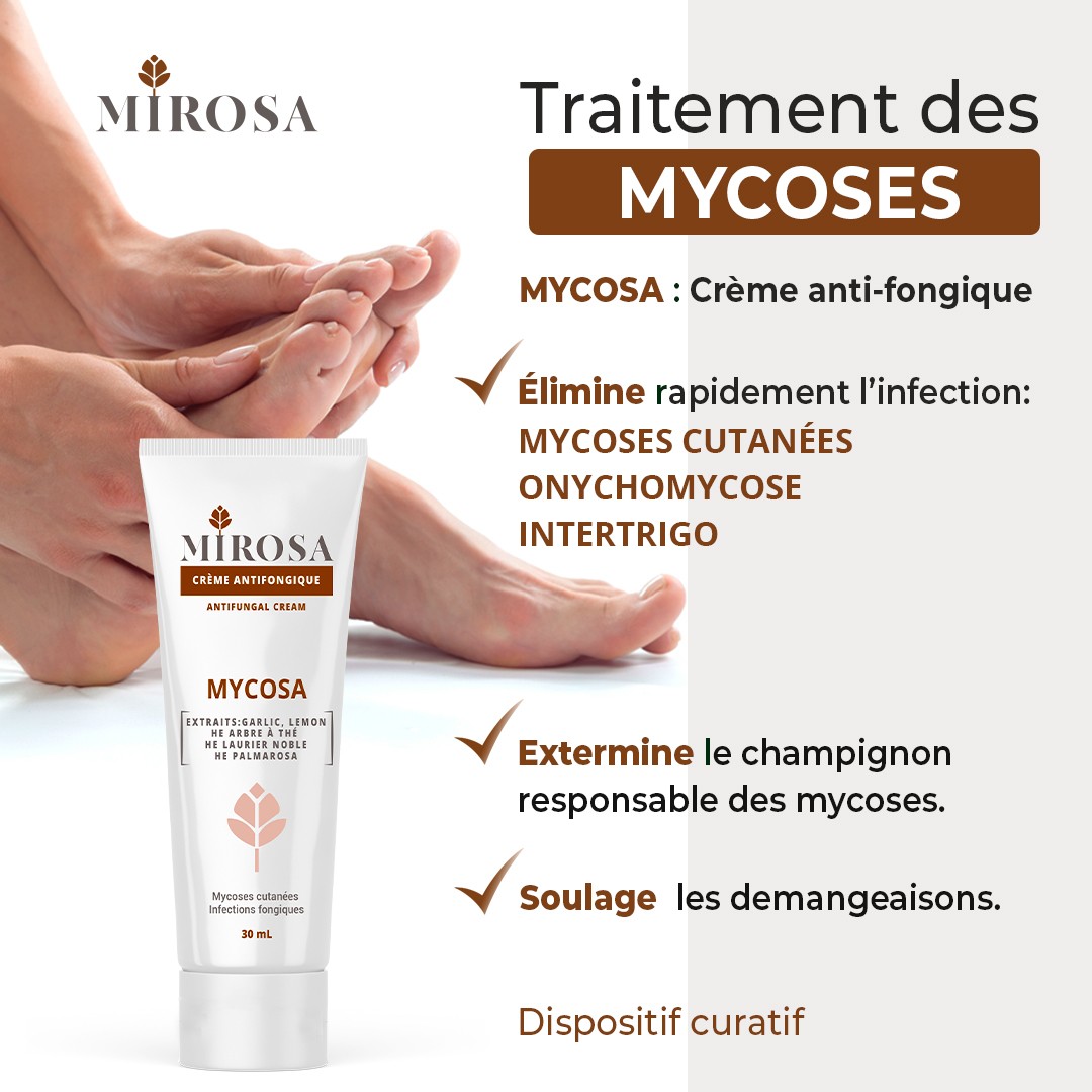 MIROSA MYCOSA CREME ANTIFONGIQUE 30ML